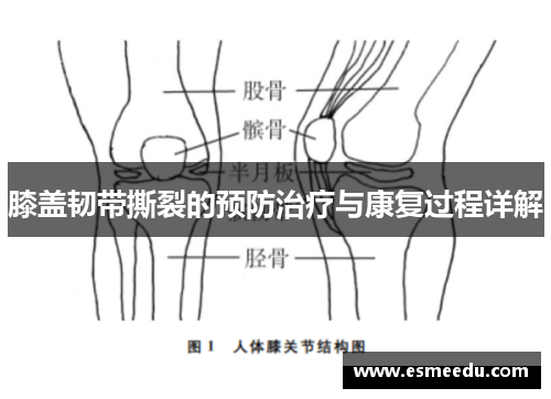 膝盖韧带撕裂的预防治疗与康复过程详解